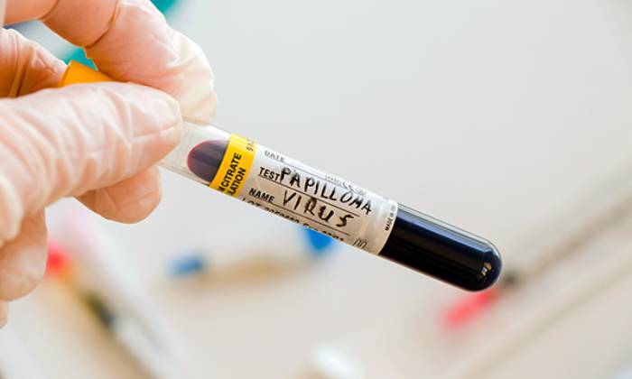 دوره نهفتگی HPV